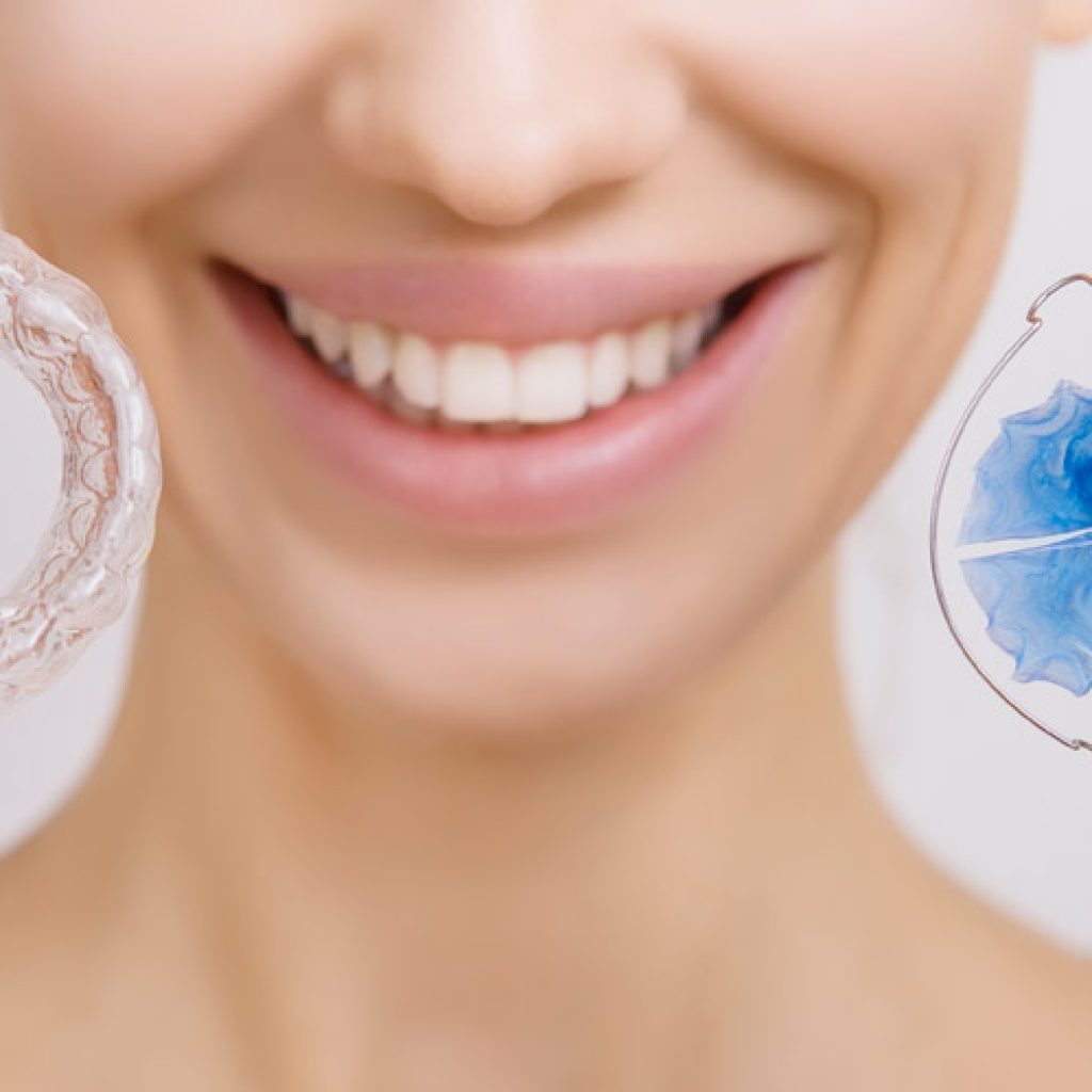 Estos son dos de los tipos de ortodoncia invisible que existen.