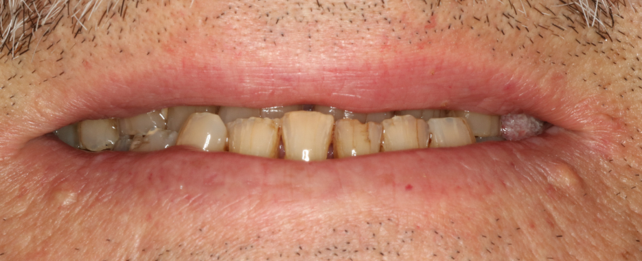 antes de realizar tratamiento estetica