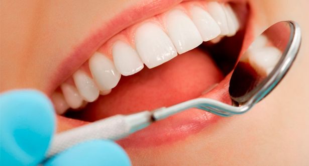 blanqueamiento dental