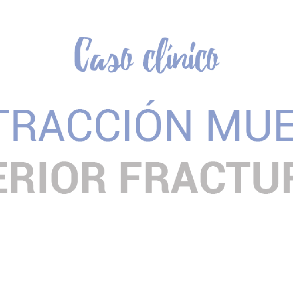 caso clinico extraccion muela superior rota