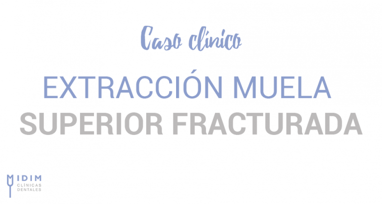 caso clinico extraccion muela superior rota