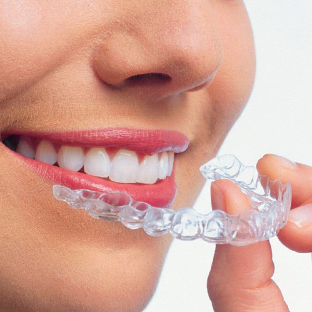 Algunas claves de la férula dental