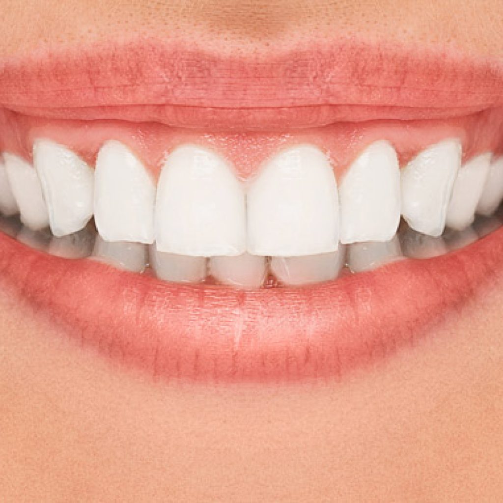 como eliminar el sarro de los dientes