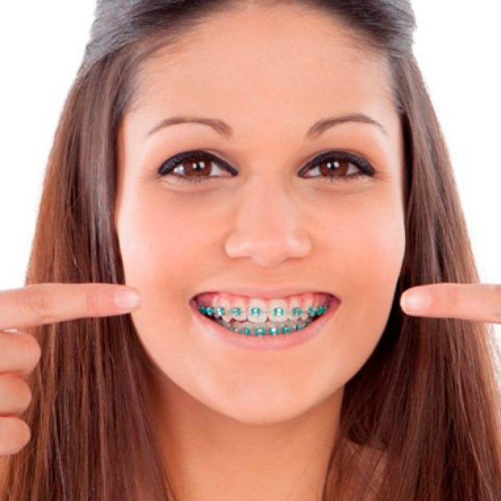 consecuencias de la mala higiene de los brackets