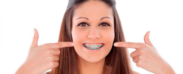 consecuencias de la mala higiene de los brackets