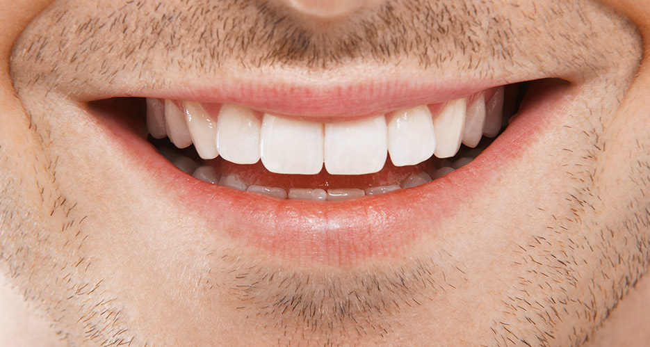 consejos para saber que es la periodontitis dental