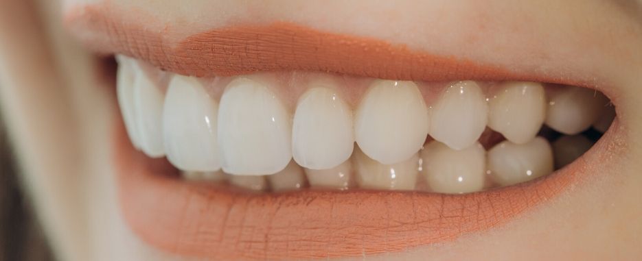 cuales son las ventajas de los implantes dentales de carga inmediata cuales son las ventajas de los implantes dentales de carga inmediata