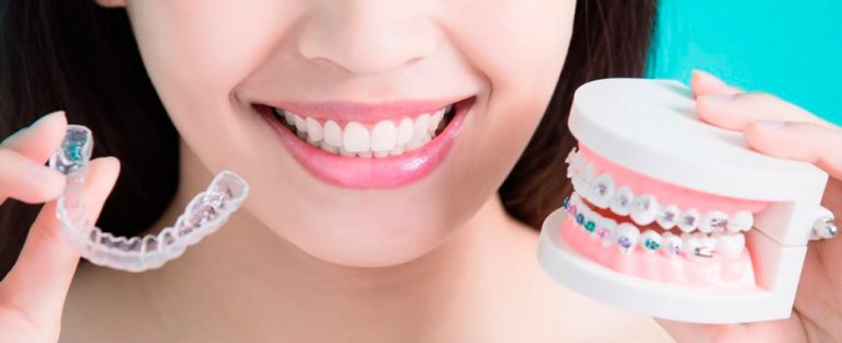 cuanto dura el tratamiento de invisalign