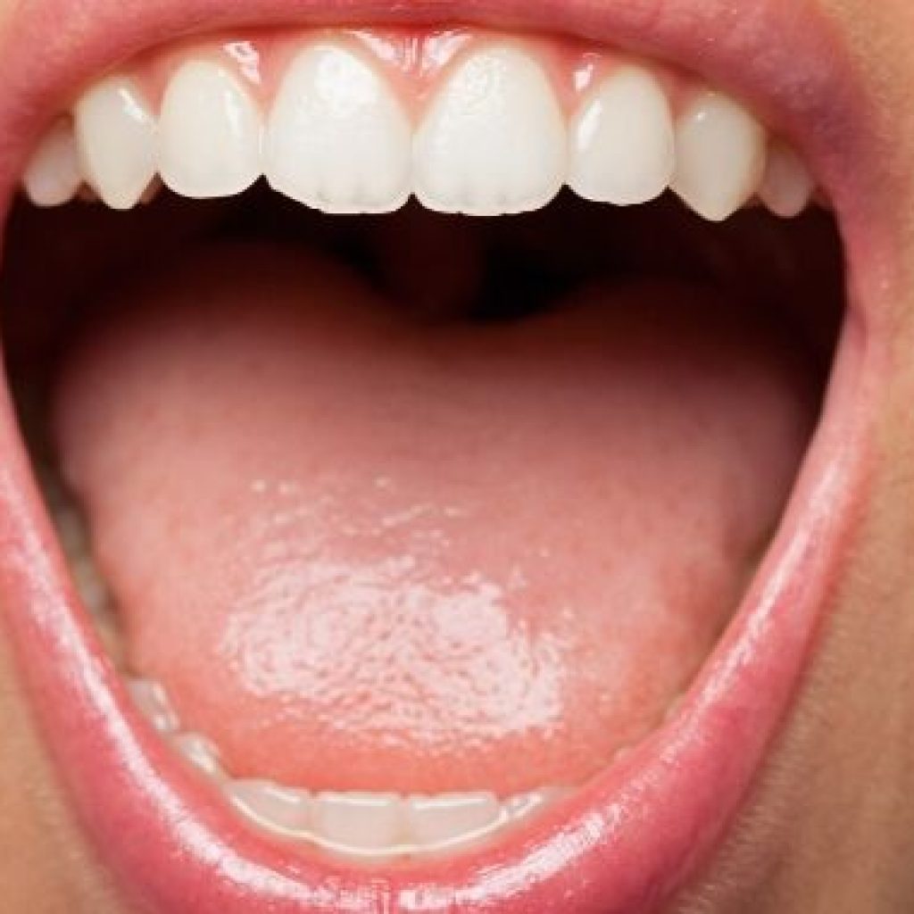 cuanto tarda en cicatrizar un implante dental