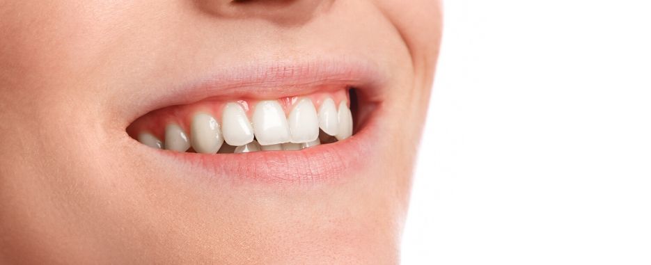 cuanto tarda en cicatrizar un implante dental cuanto tardara en cicatrizar un implante dental