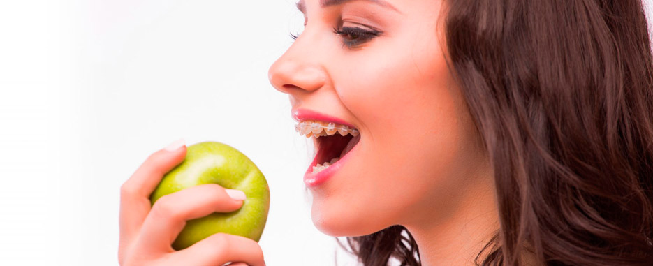 cuidado de los brackets