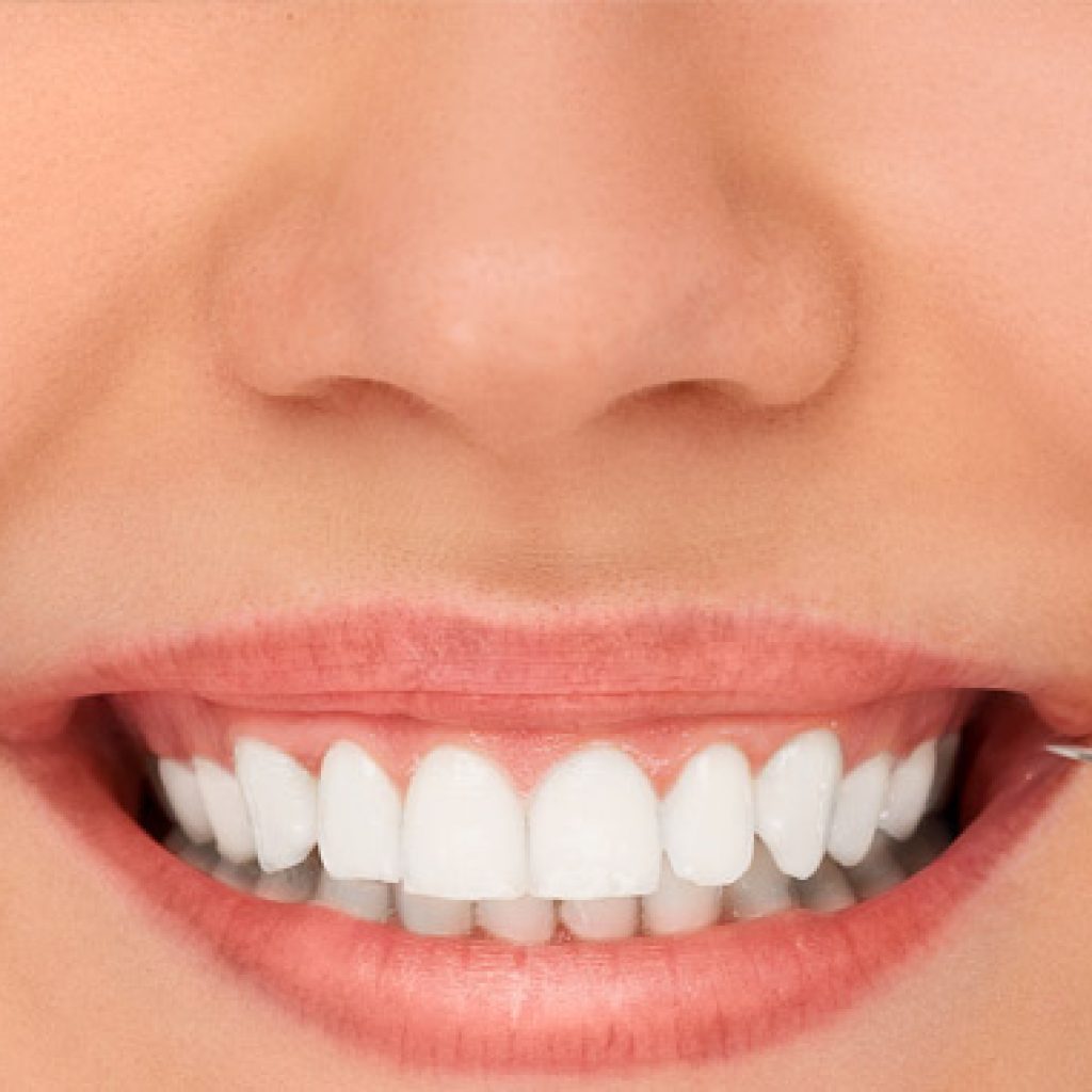 desgaste dental causas y tratamientos