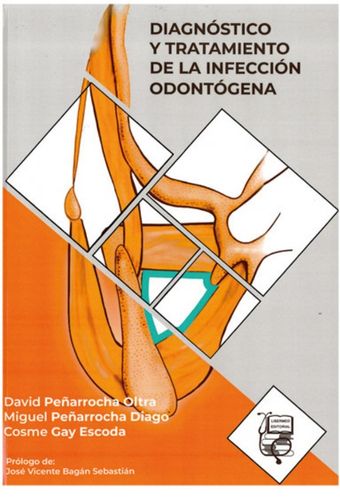 diagnostico tratamiento de la infeccion odontogena
