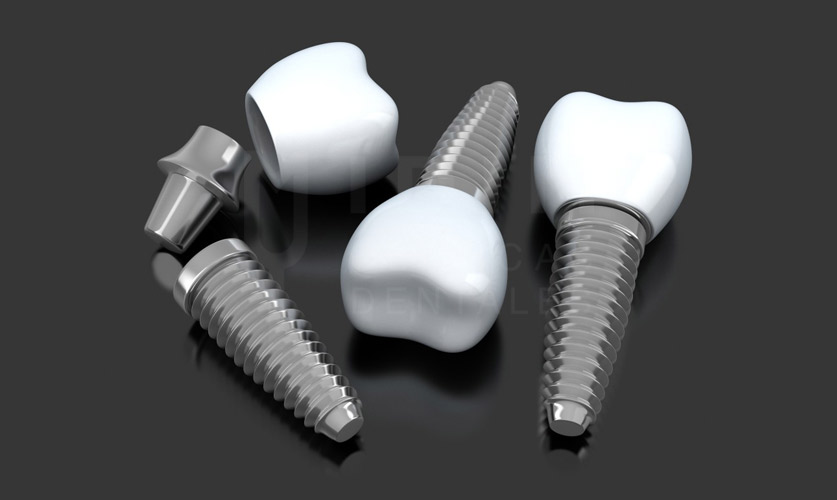 dientes en un dia dientes-en-un-dia