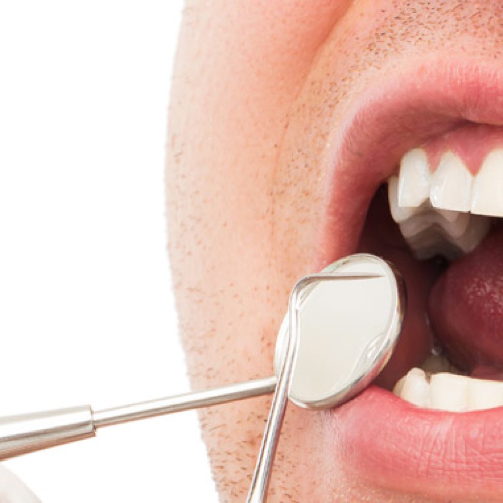 dientes oscuros o manchas dentales causas y soluciones