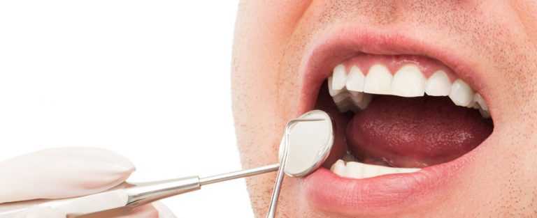 dientes oscuros o manchas dentales causas y soluciones