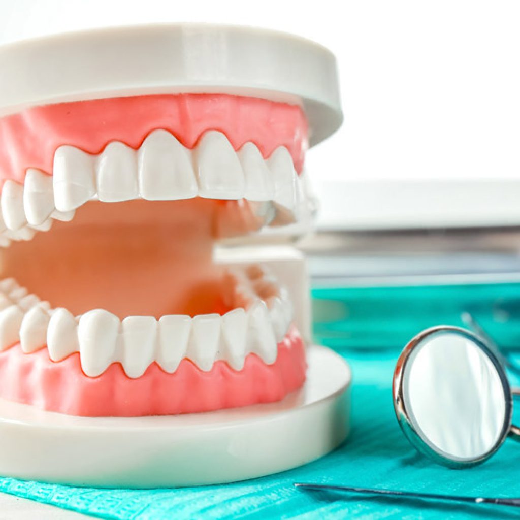 tipos de prótesis dentales