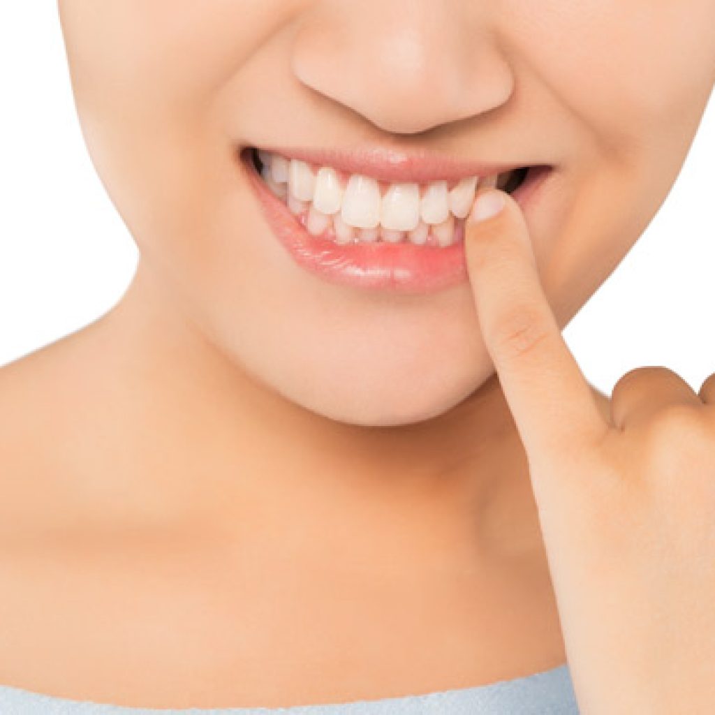 encias blancas causas y solucion