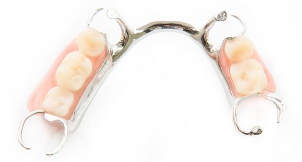 fases cad cam dental