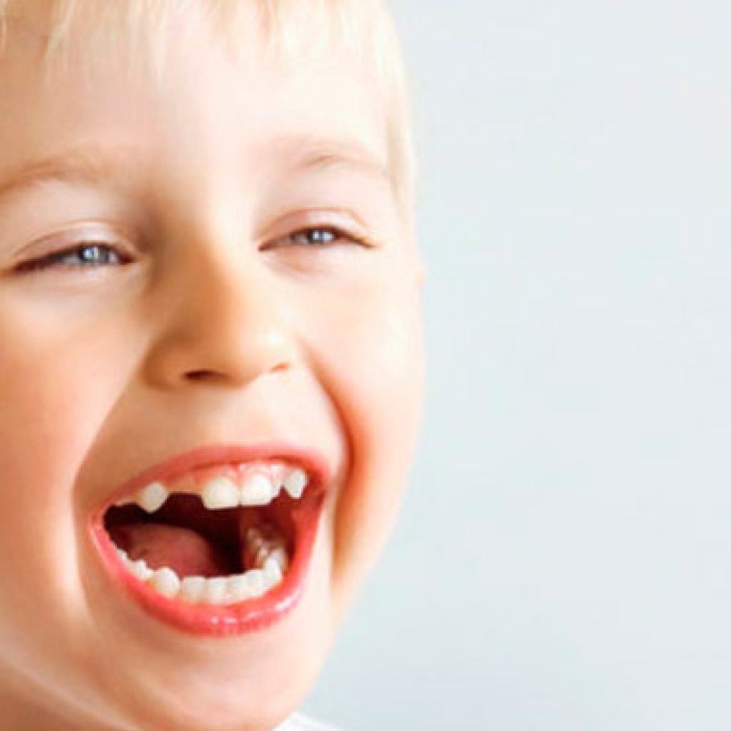 la agenesia dental o ausencia de dientes congenita