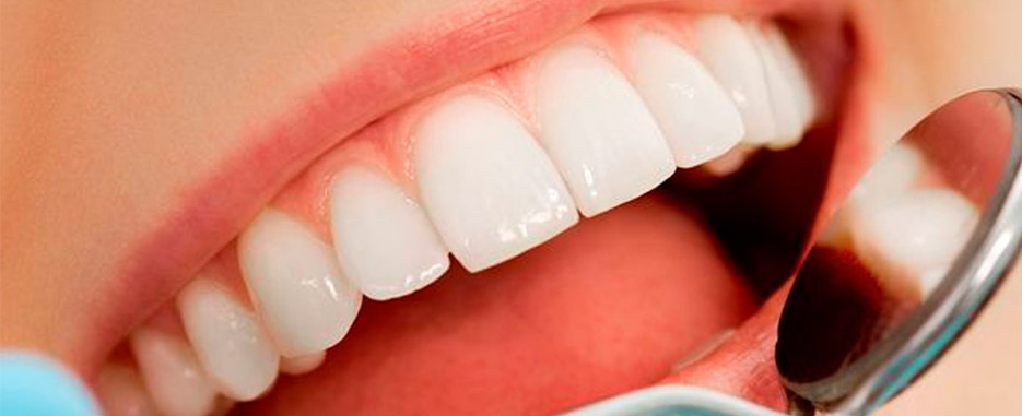 como cuidar los implantes dentales limpieza implantes dentales