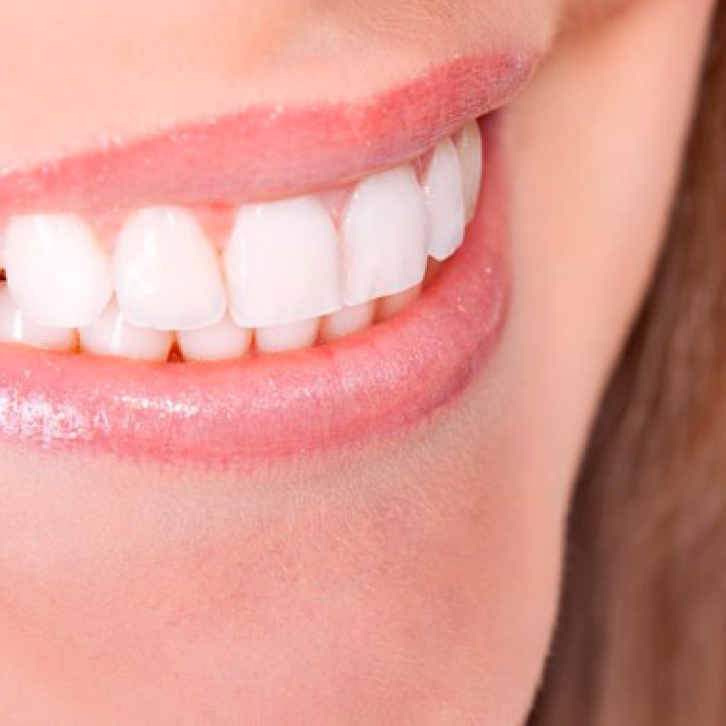 parestesia tras tratamiento de implantes dentales