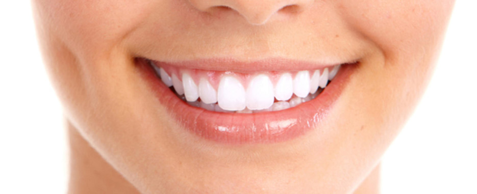 por que salen manchas blancas en los dientes