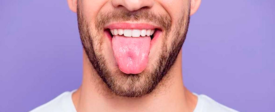 por que tengo la lengua amarilla