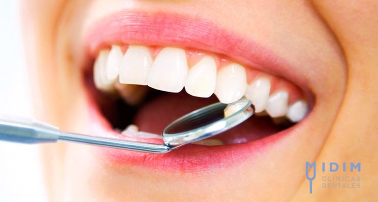Prevenir la periimplantitis