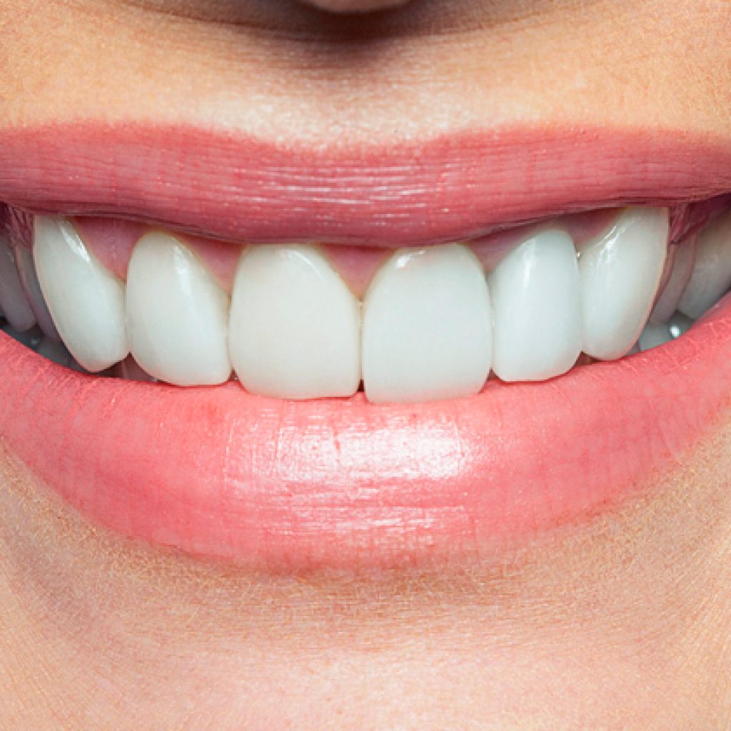 problemas periodontitis y diabetes