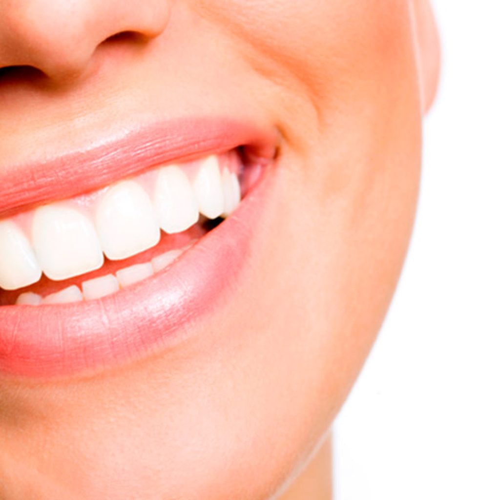 Que es la gingivitis y como prevenirla