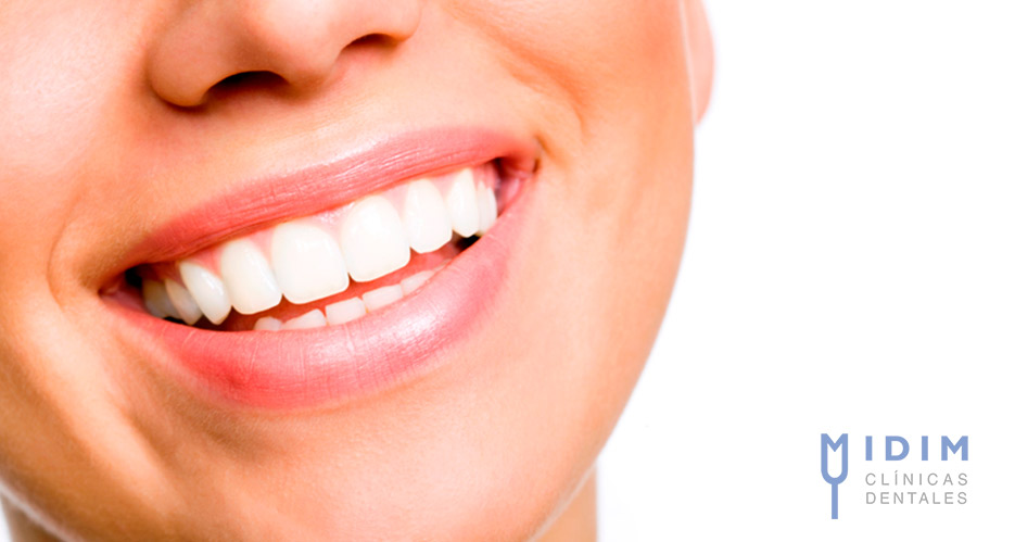 Que es la gingivitis y como prevenirla