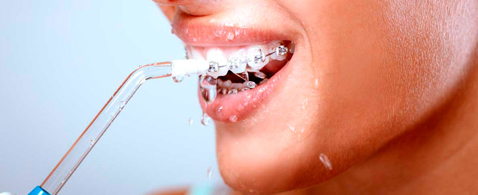 que es un irrigador dental