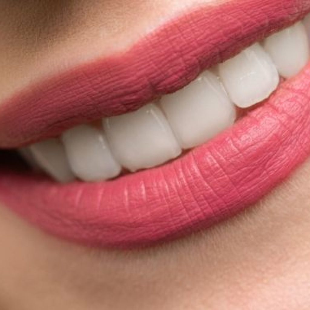 que es una reendodoncia y cuando usarla