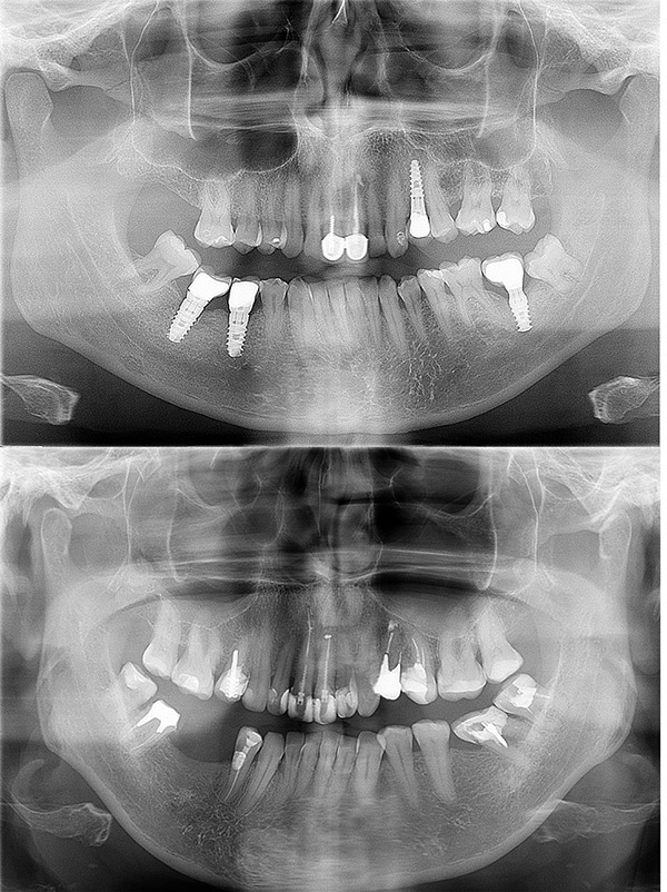 radiografía para clínica dental