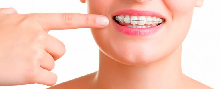 recomendaciones para pacientes con ortdoncia
