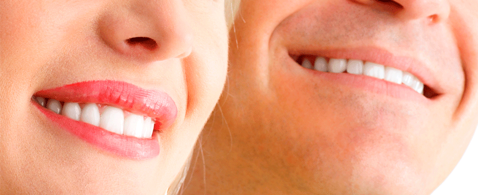 pareja con implante dental