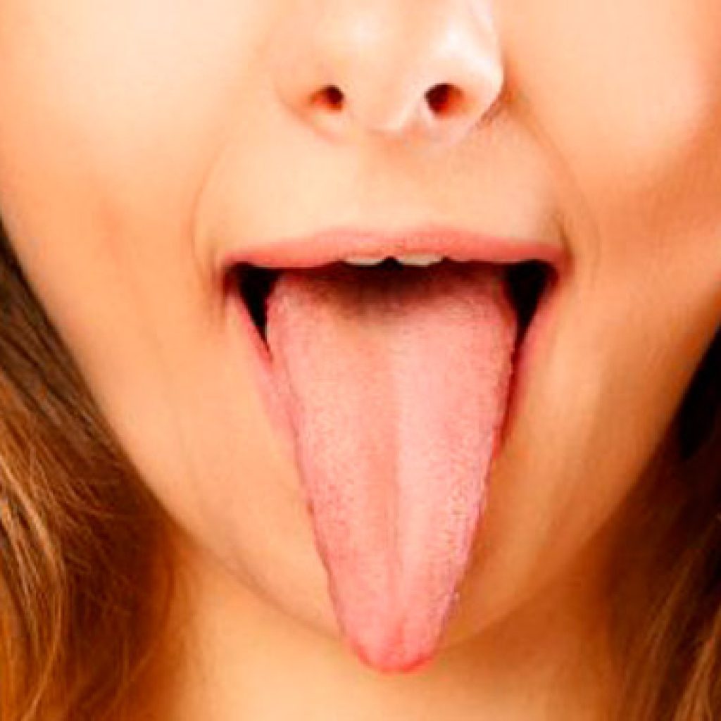 tengo la lengua amarilla