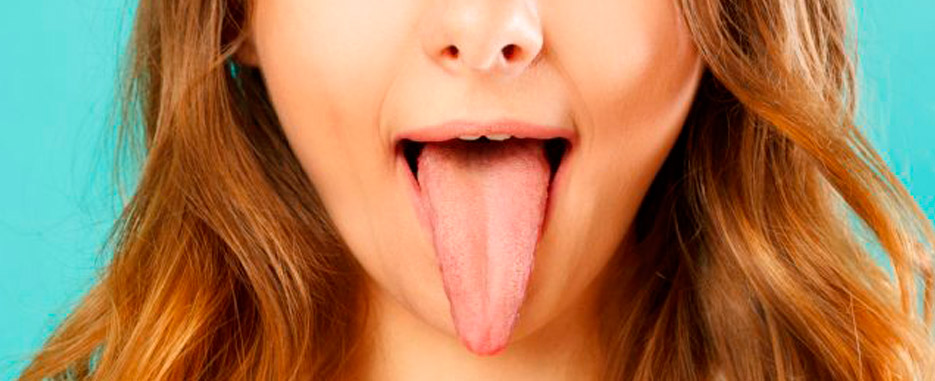 tengo la lengua amarilla