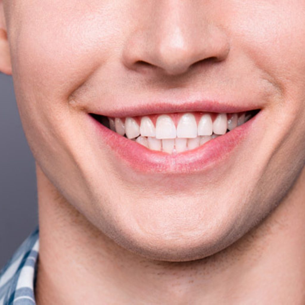 tengo puntos blancos en las encias a que se debe