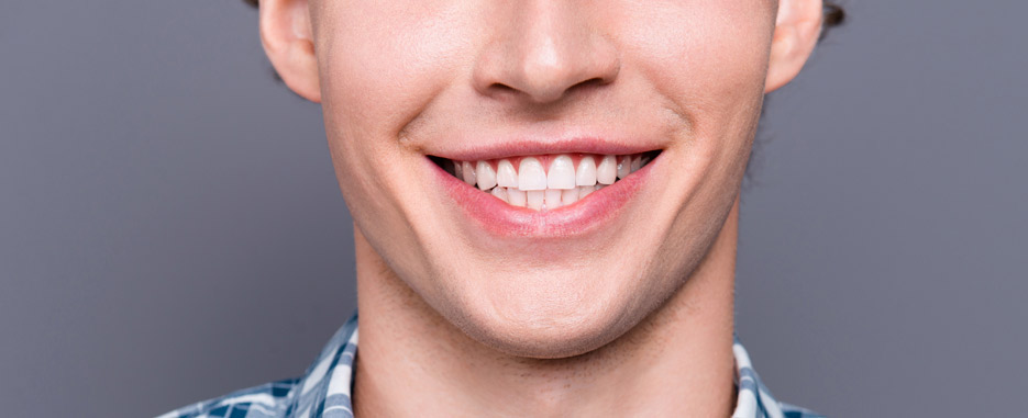 tengo puntos blancos en las encias a que se debe