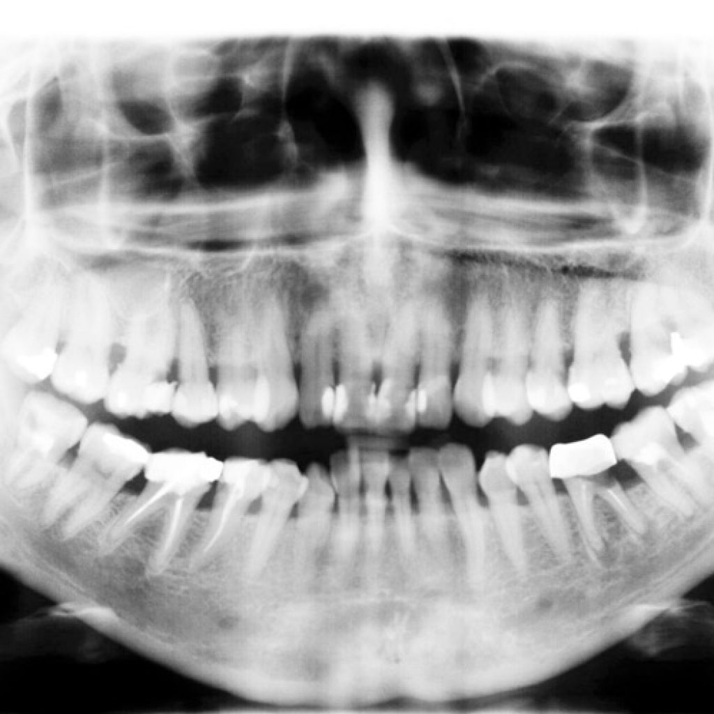 Tipos de radiografias en clinica dental