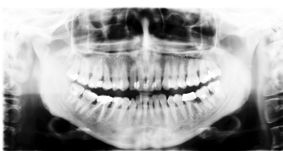 Tipos de radiografias en clinica dental