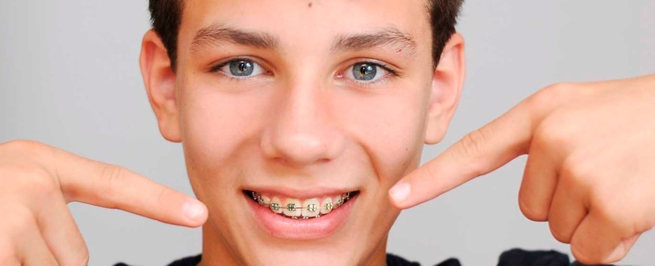 la agenesia dental o ausencia de dientes congenita tratamiento de la agenesia dental