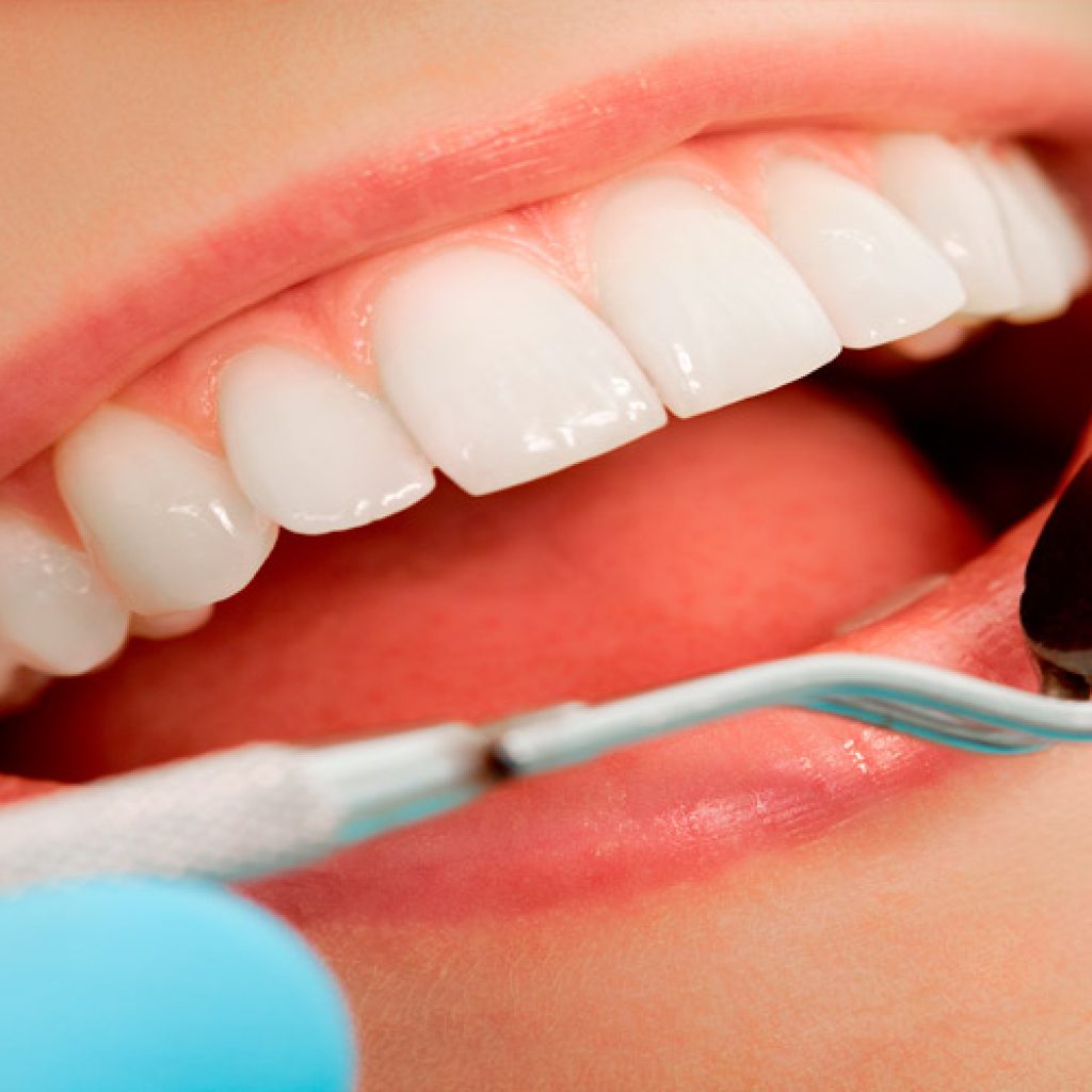 pertenencia implantes dentales