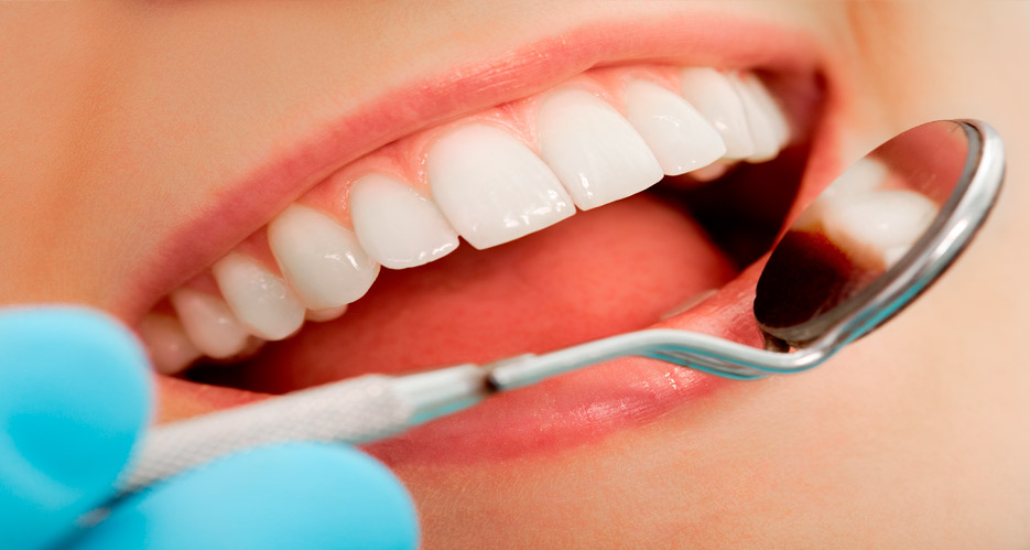 pertenencia implantes dentales