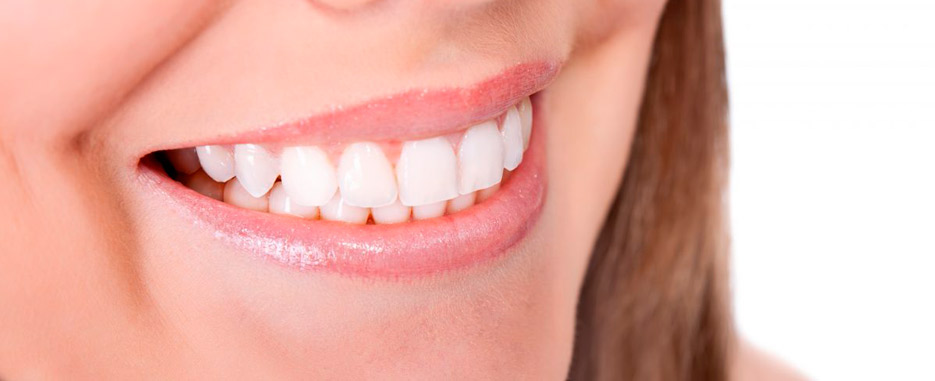 ventajas de los implantes dentales inmediatos